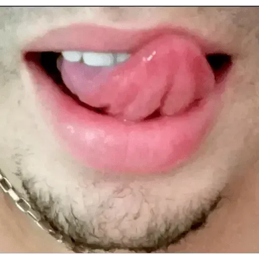 Hot