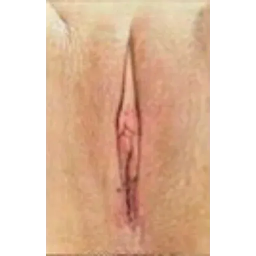 Tipos de vaginas