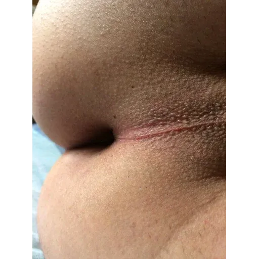 Ass