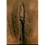 Vagina