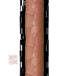 Penis