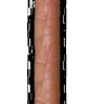 Penis